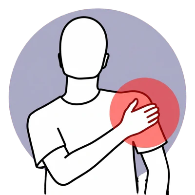 Illustration of shoulder and arm tension