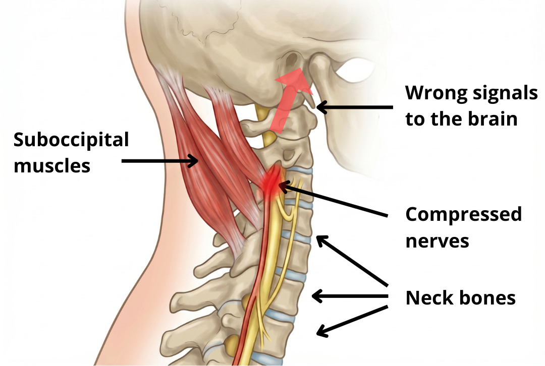 neck (1).png__PID:3001c3eb-38e1-423d-adb1-ee0e187ec648