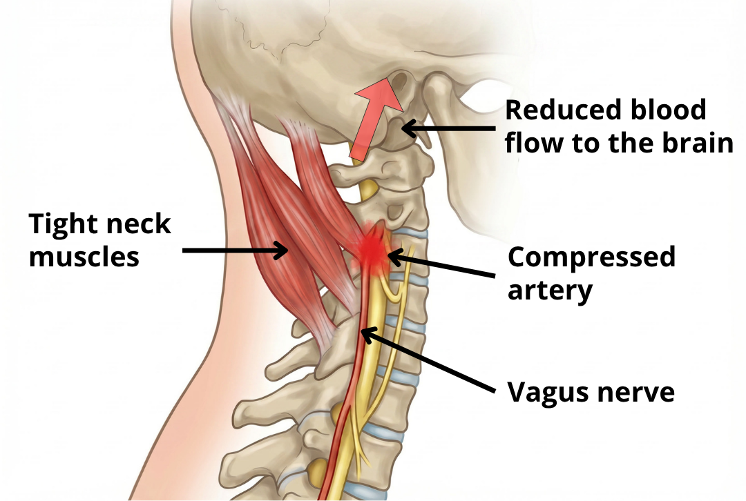 neck (6).png__PID:400b3d97-caf6-4066-a684-f533047560fa